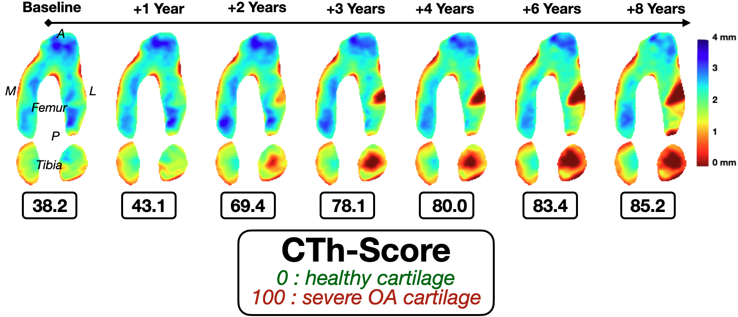 Overview of the automatic cartilage thickness framework