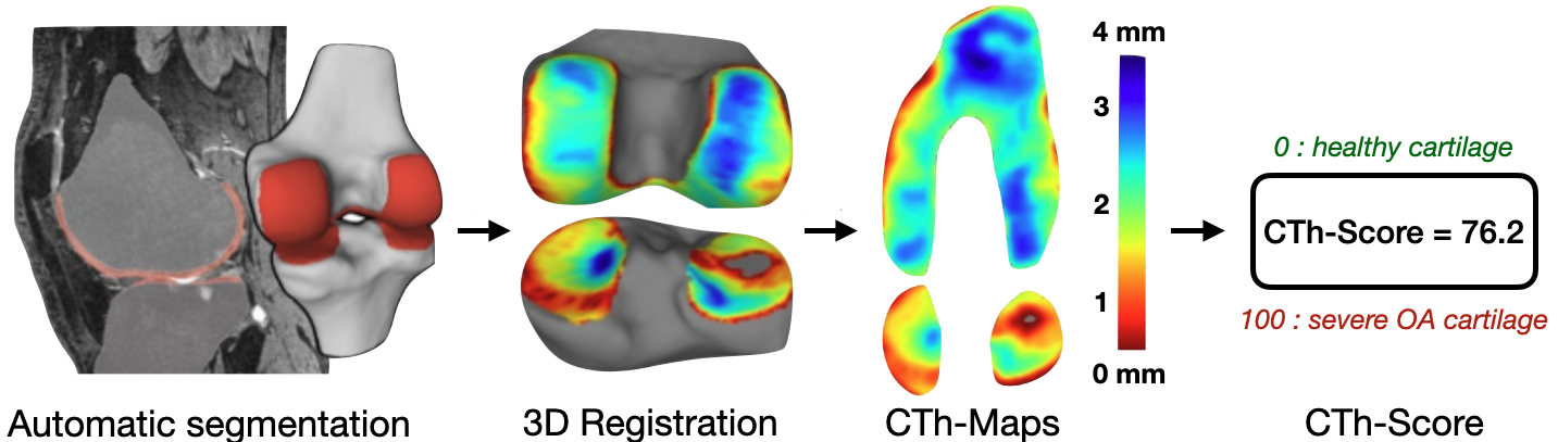 Overview of the automatic cartilage thickness framework